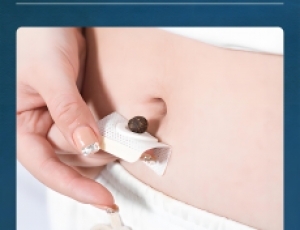 艾草肚臍貼：傳統智慧與現代便捷的完美融合